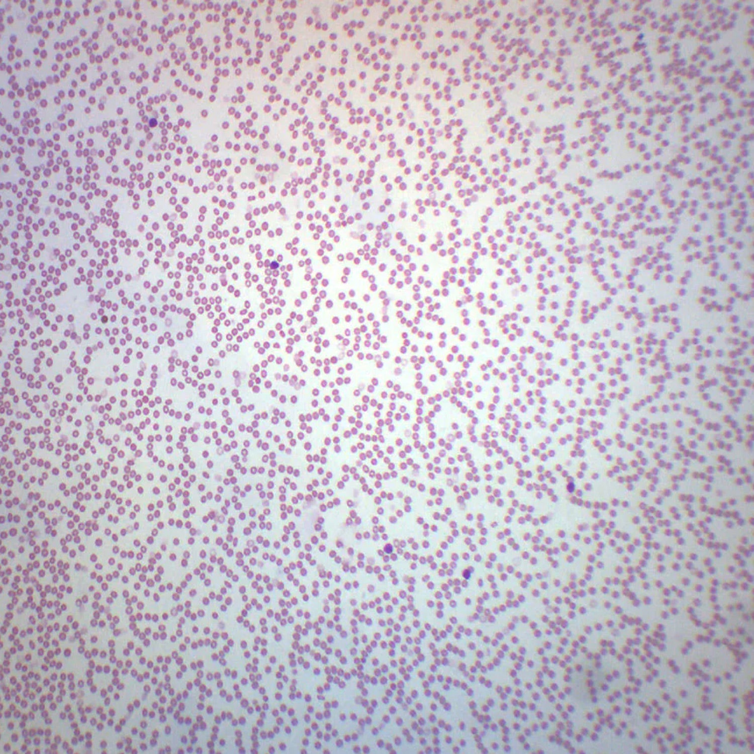 Human Blood Smear Microscope Slide – Prepared Wright’s Stain, 75x25mm – Red & White Blood Cells + Platelets – Biology Teaching Aid