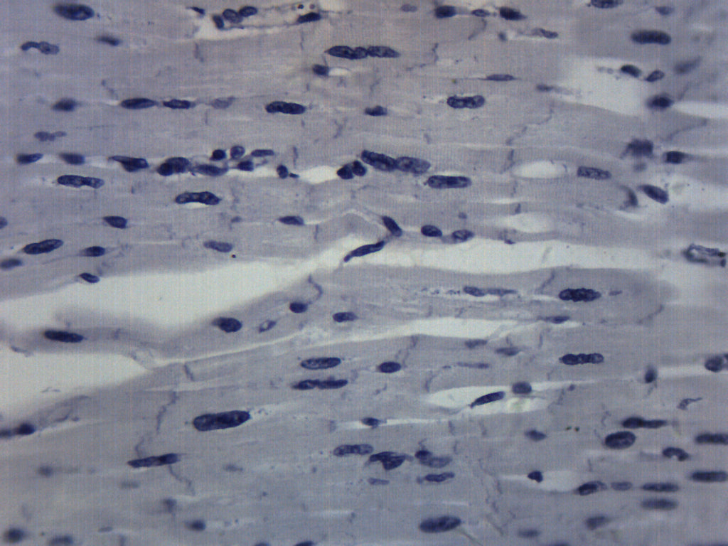 Prepared Cardiac Muscle Microscope Slide – Mammalian Longitudinal Section, 75x25mm, Stained for Biology Education