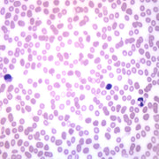 Human Blood Smear Microscope Slide – Prepared Wright’s Stain, 75x25mm – Red & White Blood Cells + Platelets – Biology Teaching Aid