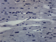 Prepared Cardiac Muscle Microscope Slide – Mammalian Longitudinal Section, 75x25mm, Stained for Biology Education